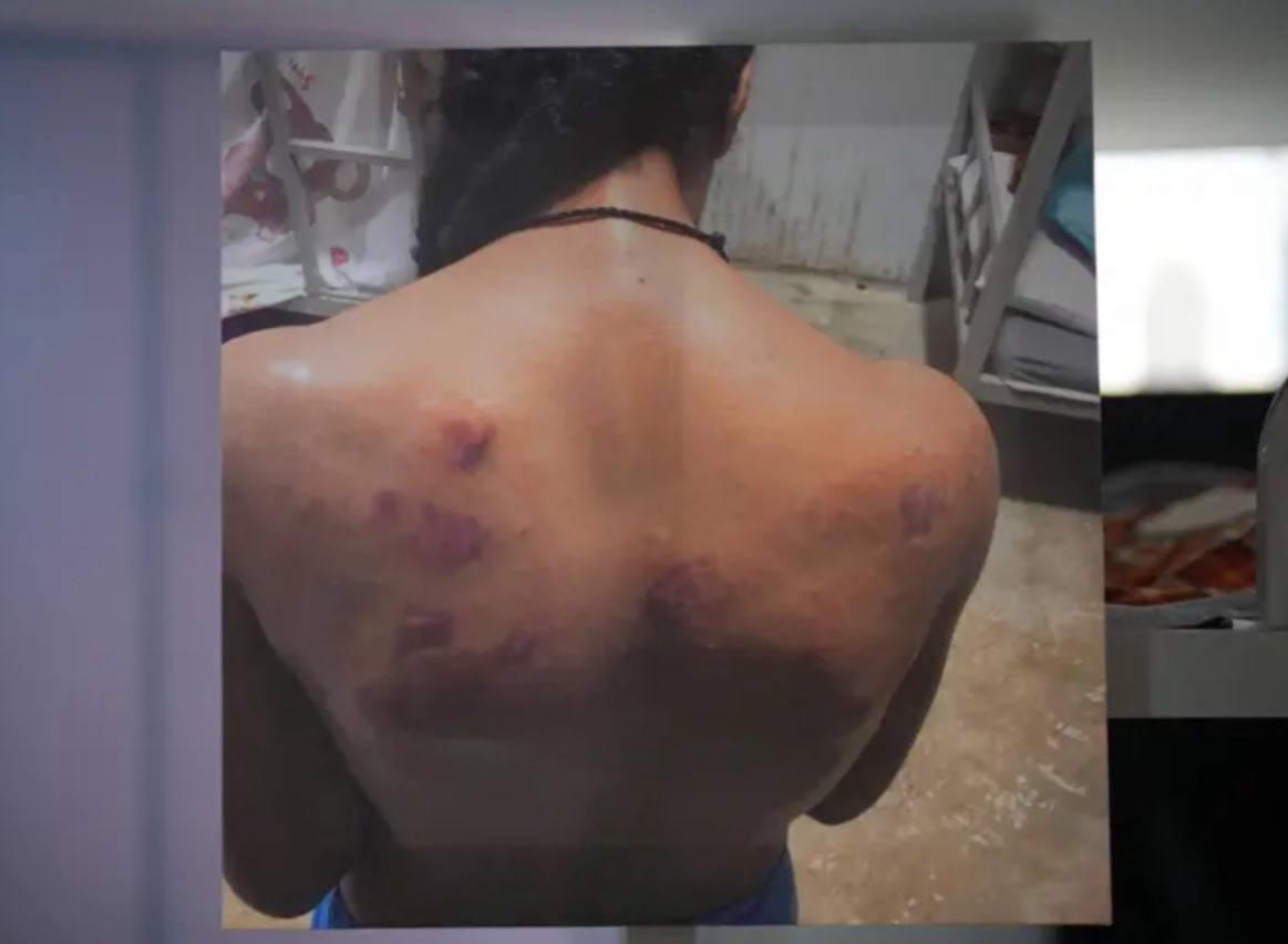 曼谷外国记者协会正在举办一场展览，讲述缅甸妙瓦底诈骗园区受害者遭遇的虐待